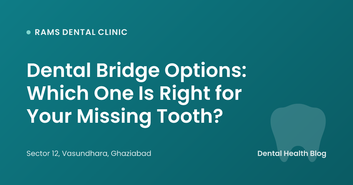 Dental Bridge Options: Which One Is Right for Your Missing Tooth?