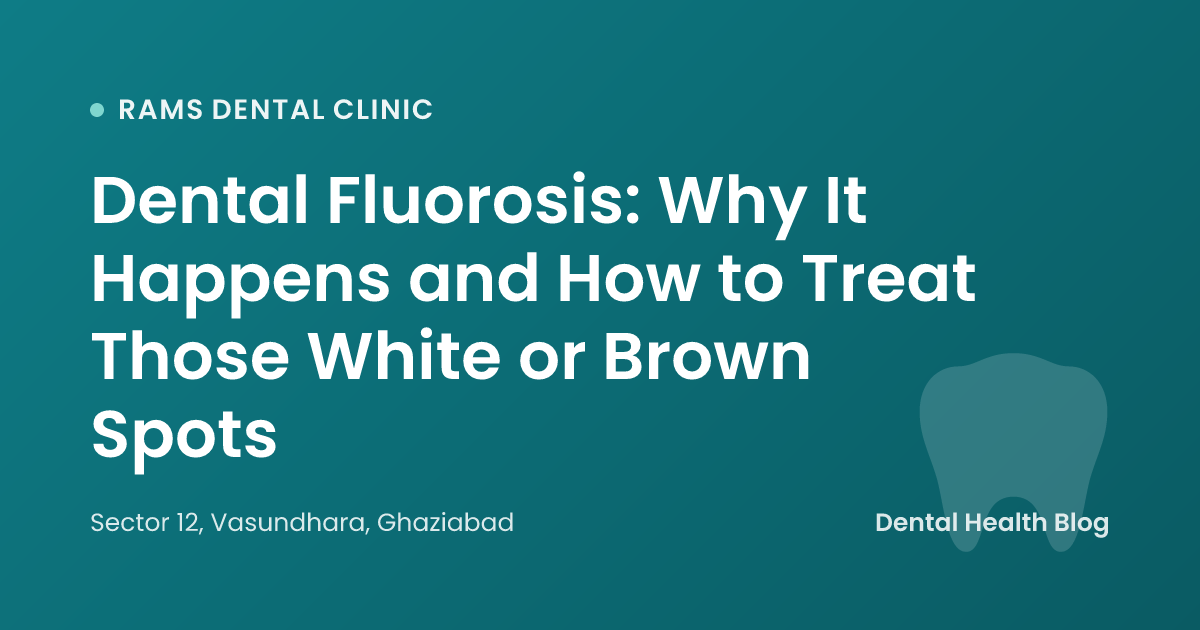 Dental Fluorosis: Why It Happens and How to Treat Those White or Brown Spots