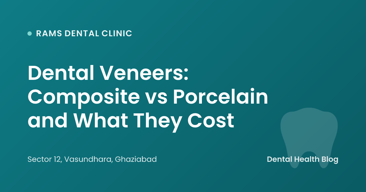 Dental Veneers: Composite vs Porcelain and What They Cost