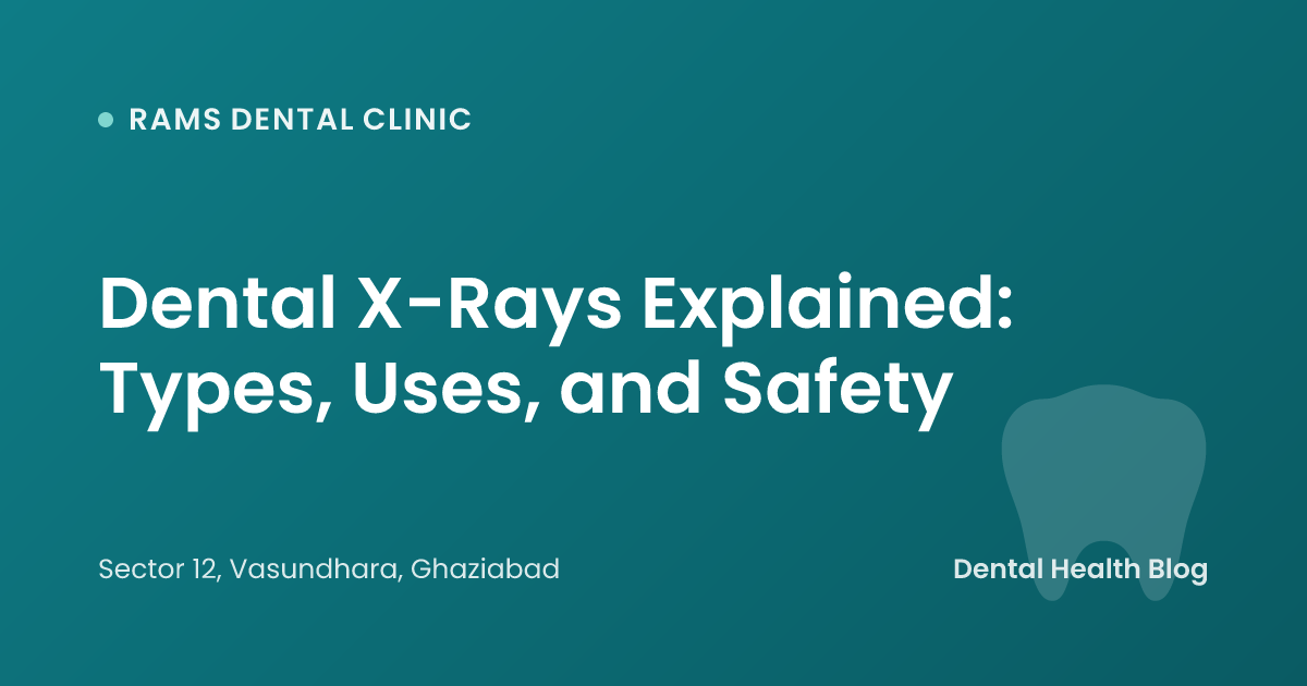 Dental X-Rays Explained: Types, Uses, and Safety