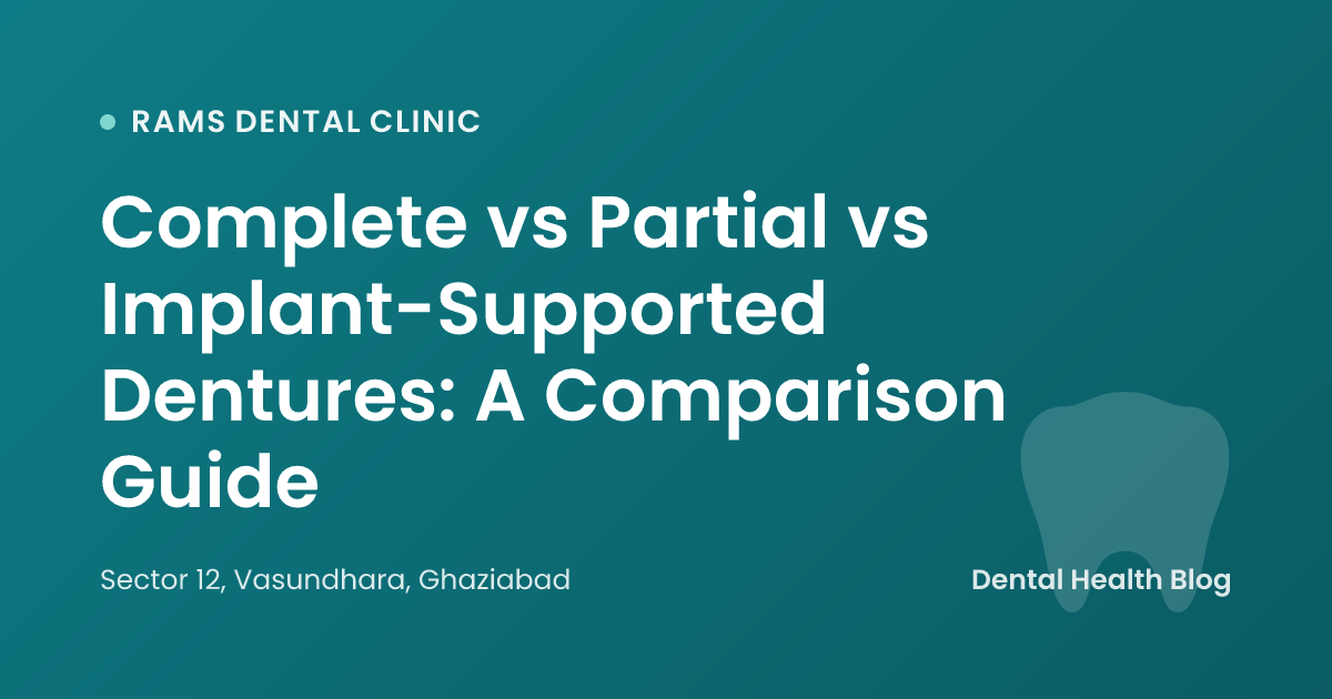 Complete vs Partial vs Implant-Supported Dentures: A Comparison Guide