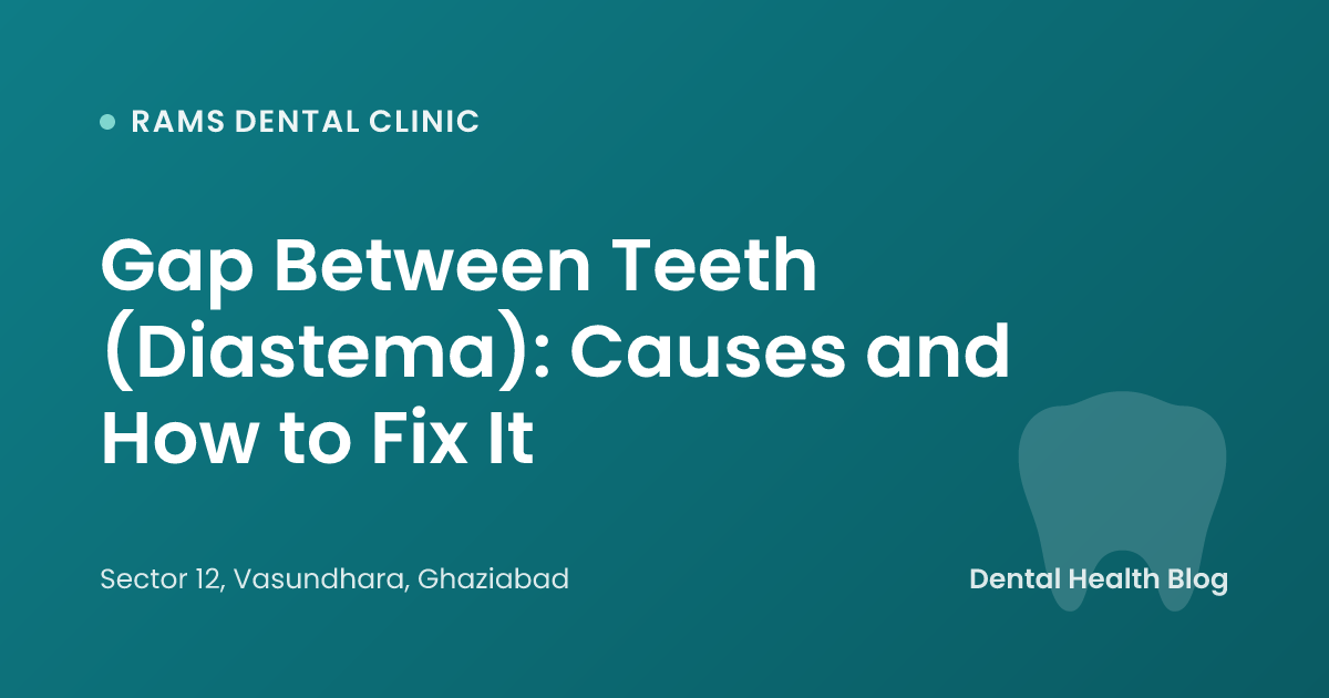 Gap Between Teeth (Diastema): Causes and How to Fix It