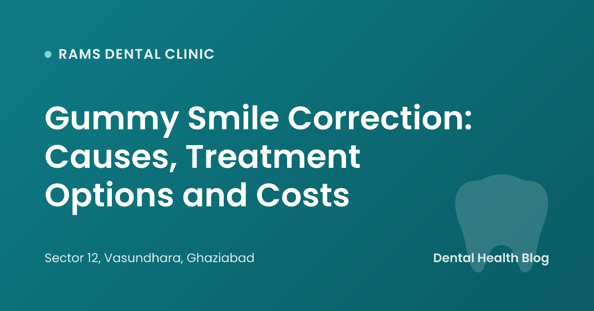 Gummy Smile Correction: Causes, Treatment Options and Costs