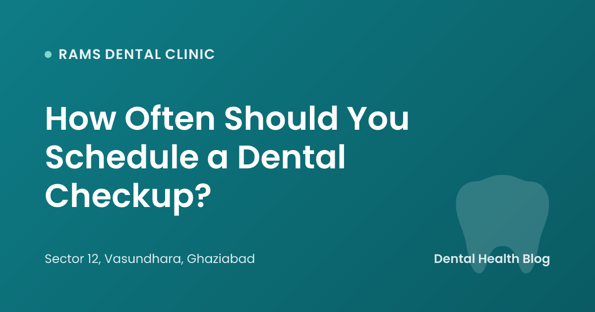 How Often Should You Schedule a Dental Checkup?