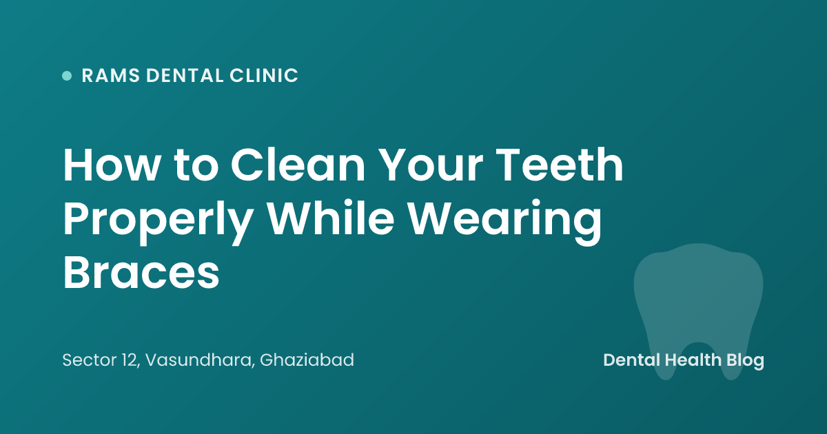 How to Clean Your Teeth Properly While Wearing Braces