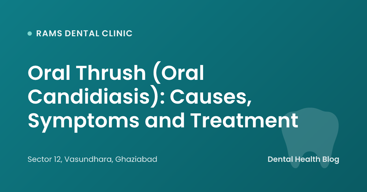 Oral Thrush (Oral Candidiasis): Causes, Symptoms and Treatment