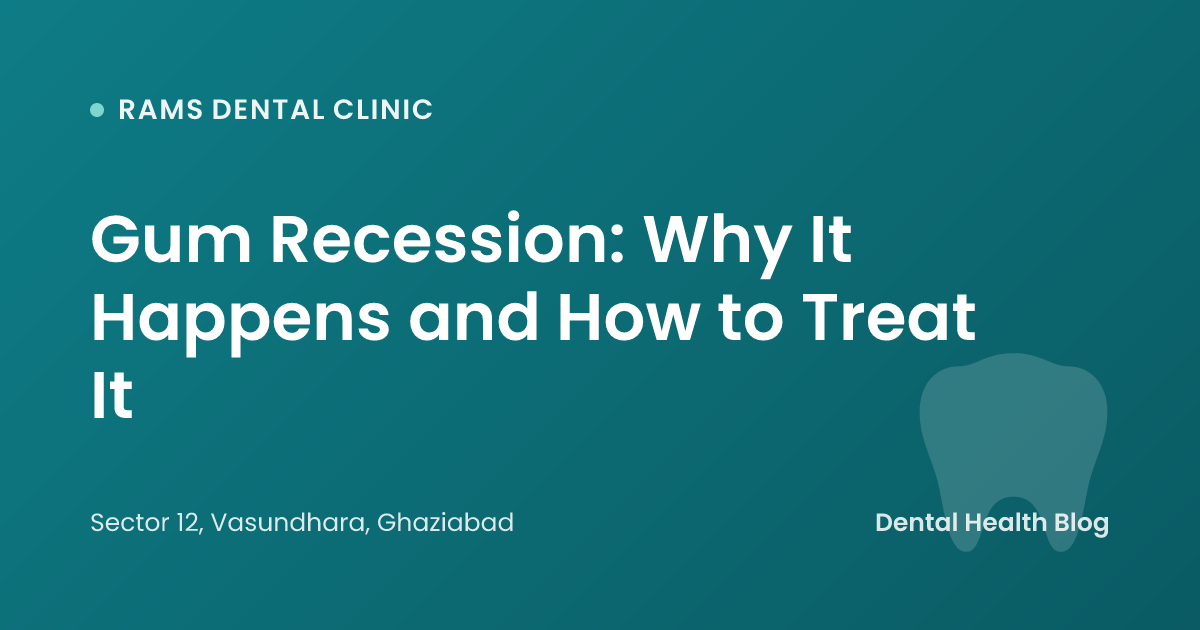 Gum Recession: Why It Happens and How to Treat It